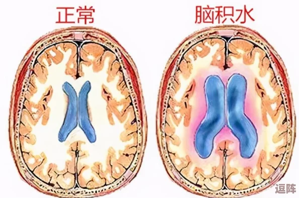 老太享受性服务HD：探讨老年人在性方面的需求与体验，揭示社会对这一话题的偏见与理解